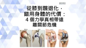 從膝到髖退化錯用身體的代價