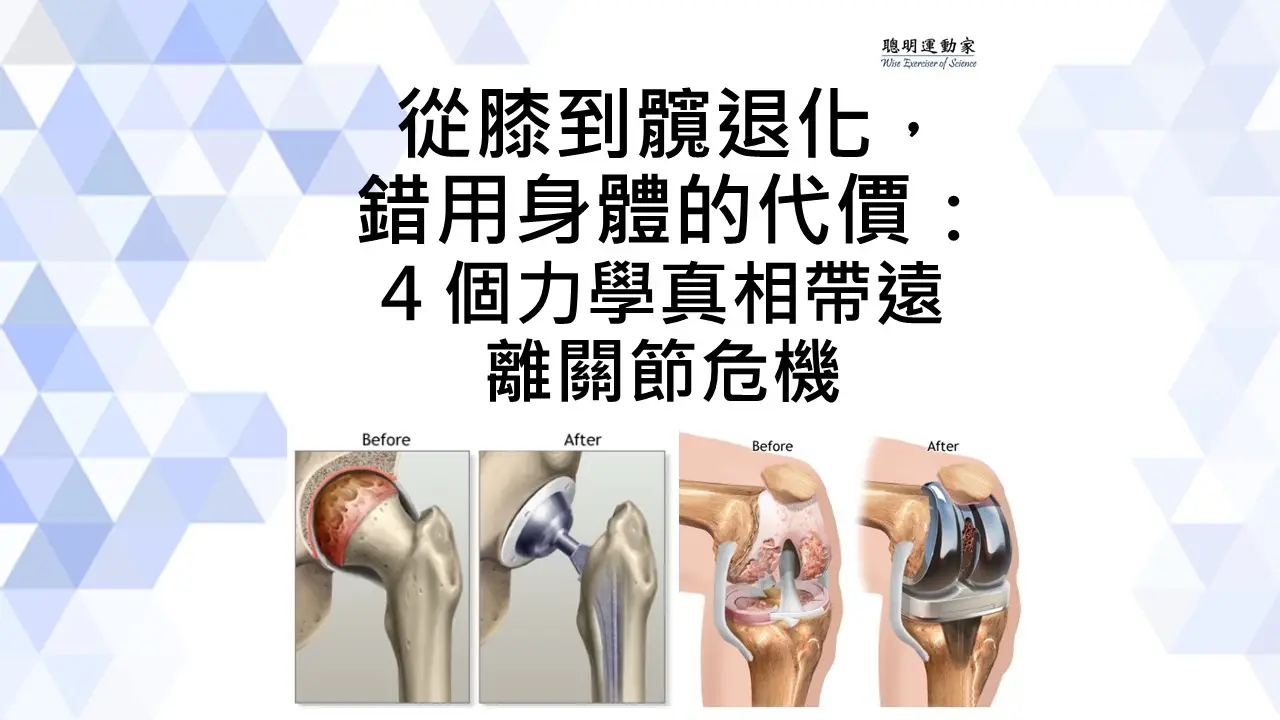 從膝到髖退化錯用身體的代價